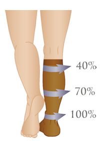 Illustration of graduated compression stockings, tightest at the ankle